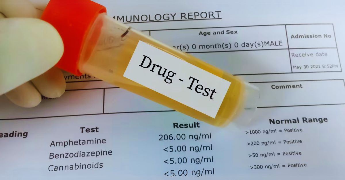 How Do Urine Drug Tests Work?